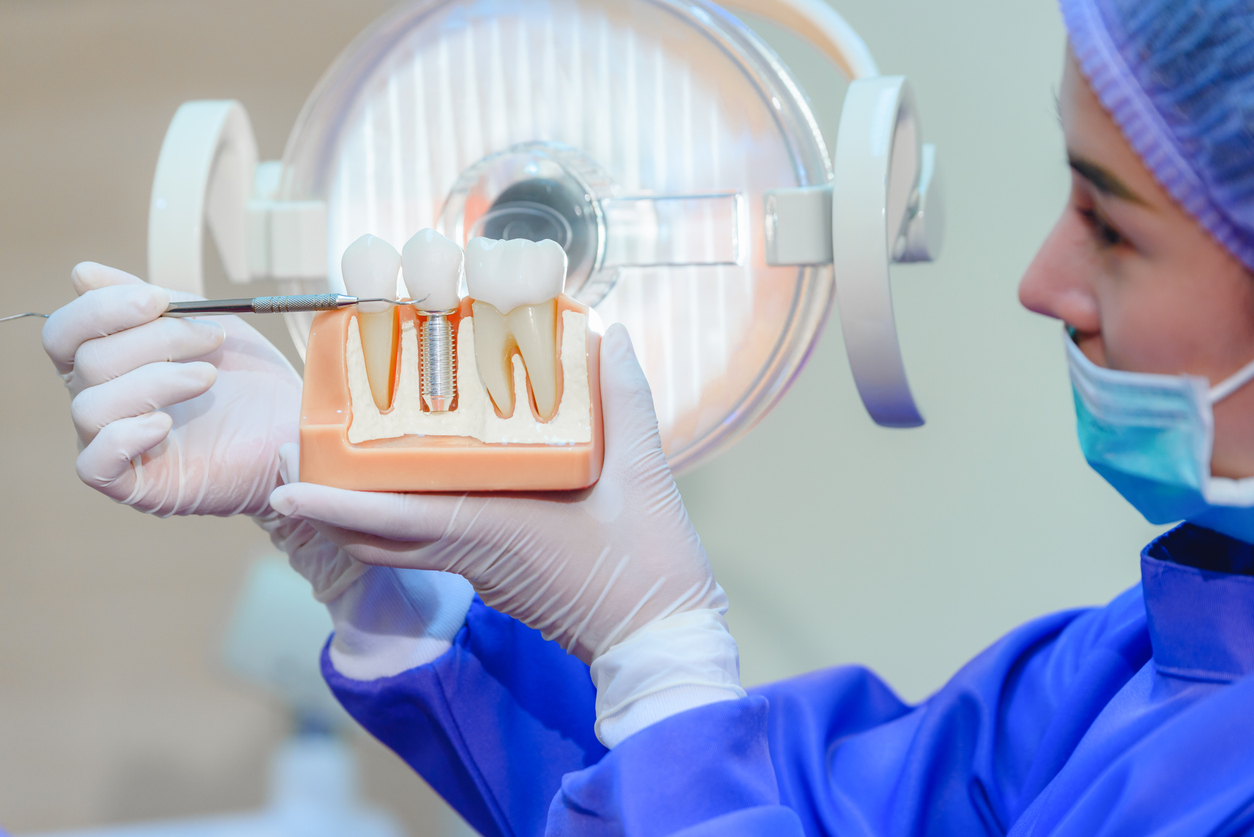 Dental showing a model of teeth with dental implants