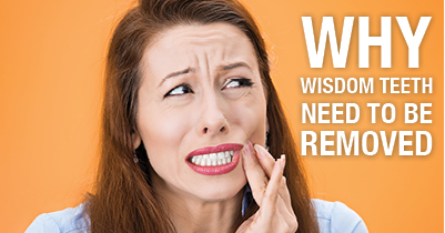 why we need our wisdom teeth removed