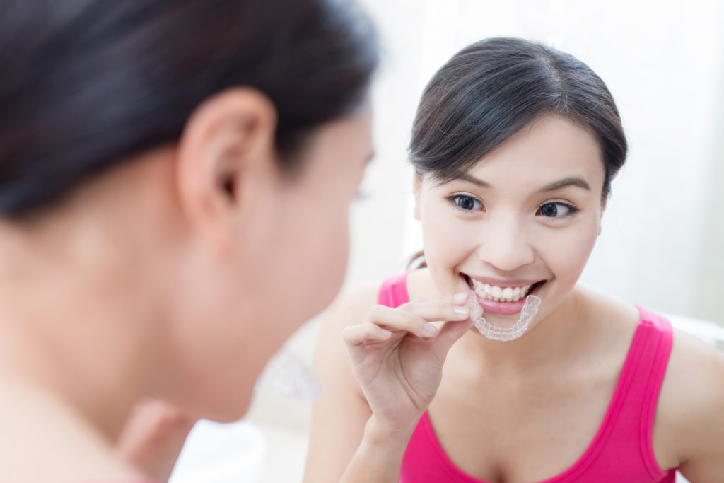 Hidden Benefits of Using Invisalign with Creekview Dental