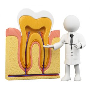 myths about root canals